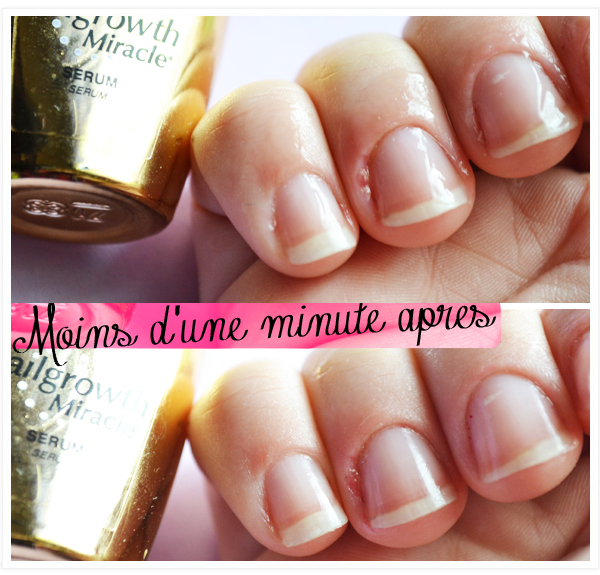 Sally Hansen Nailgrowth Miracle Serum My Pretty Little Reviews